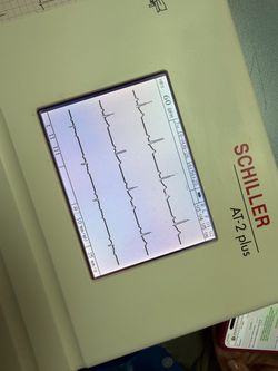Schiller AT-2 Plus Interpretative EKG