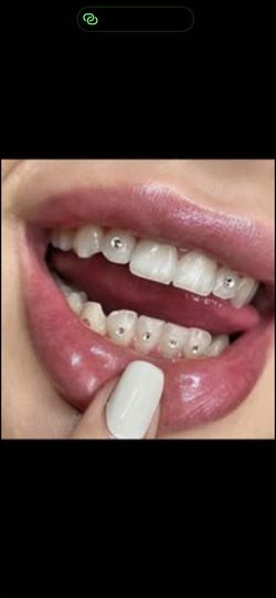 Teeth Gems. Let Your Smile Shine.  