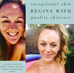 Skin and Lash Transformations Courtesy of Rodan + Fields