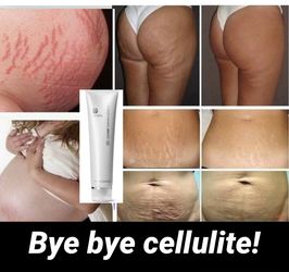 Nu Skin Dermatic Effects Cellulite Cream