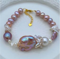 B54-Handmade flameball, Keshi And Edison Pearl S925 Bracelet