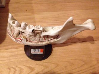 Censor jaw model