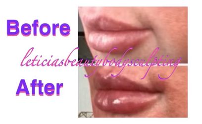 LIPS