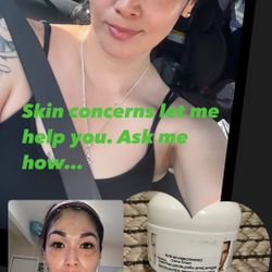 Melasma, Freckles, Acne Scars Clearing Cream/ Anti-envejecimiento Cream UNISEX