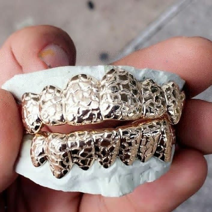 Custom Grillz