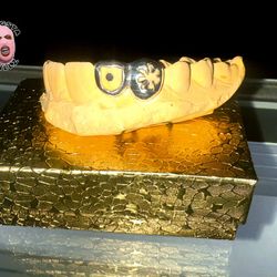 Gold Fronts