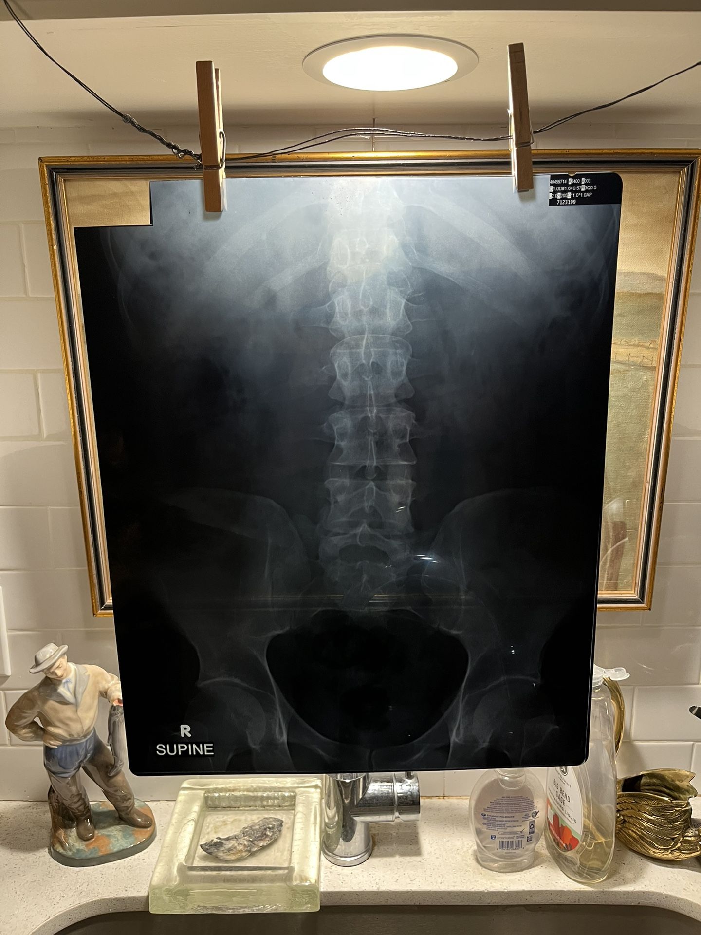 Vintage Real X-Ray photos