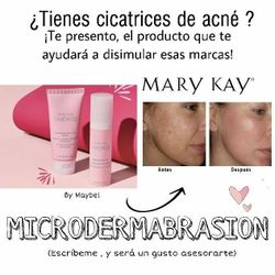 Microdermabrasion Mary Kay