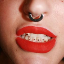 Tooth Gem