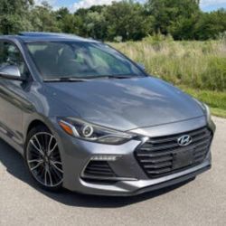 2018 Hyundai Elantra