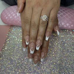 Gel X