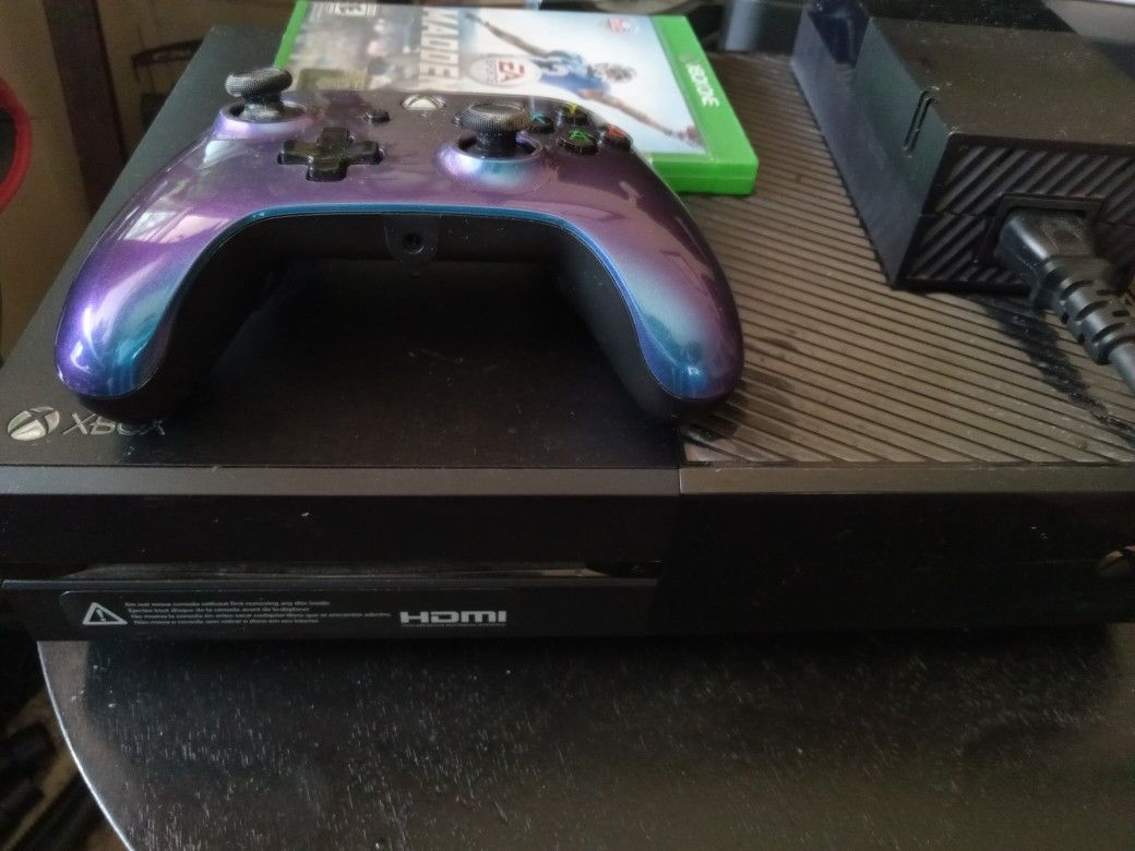 Xbox one with remote power supply might need to be replaced