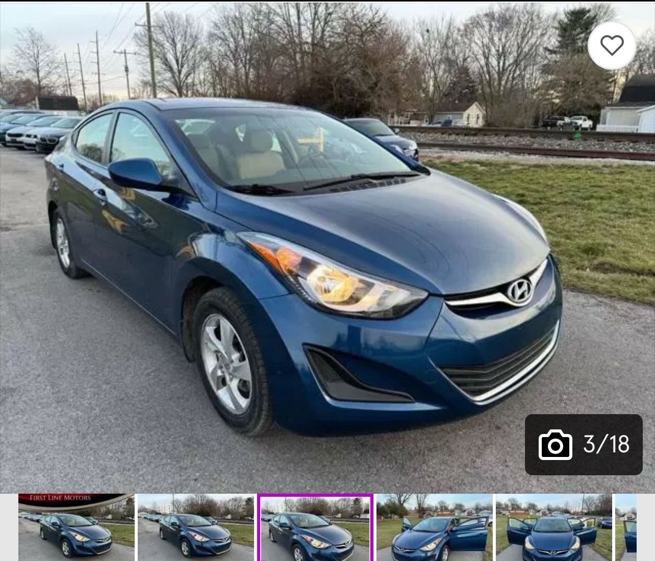 2017 Hyundai Elantra
