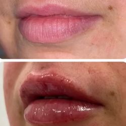 Lip gloss