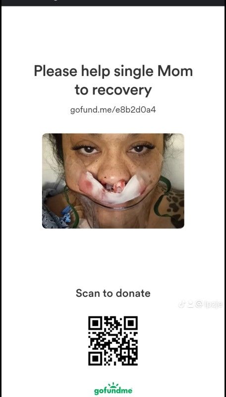 Please Help Me During My Recovery 