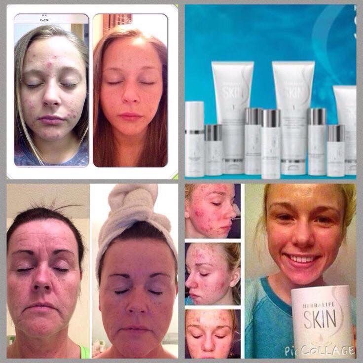 Herbalife SKIN 7 Day Results Kit