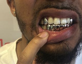 gold teeth gold grillz white gold diamonds for Sale in Hialeah FL