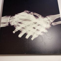 X Ray canvas Art 