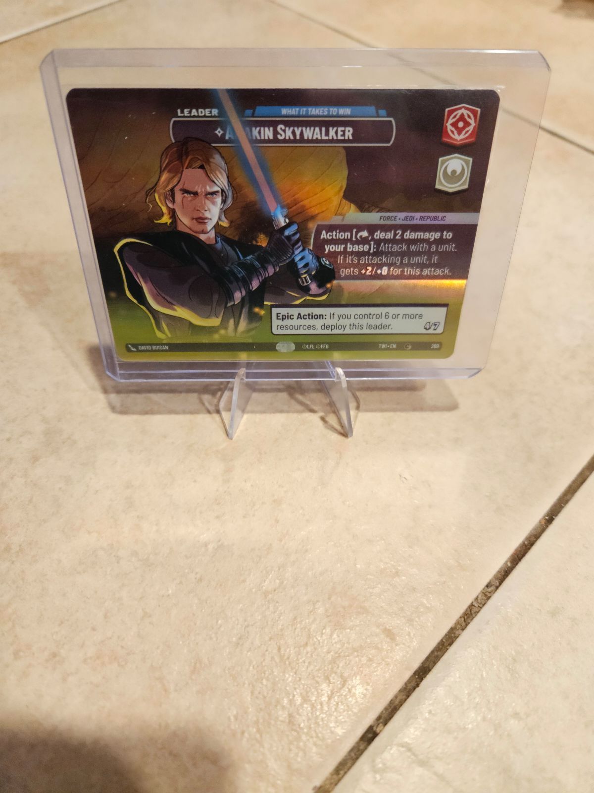 Anakin Skywalker Showcase