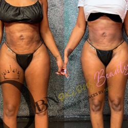 OBNoxious Beauty Buckhead BODY SCULPTING AND SKIN REJUVENATION