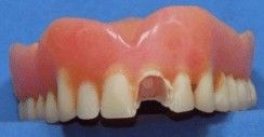 Denture Tooth Repairs