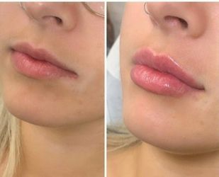 Lips