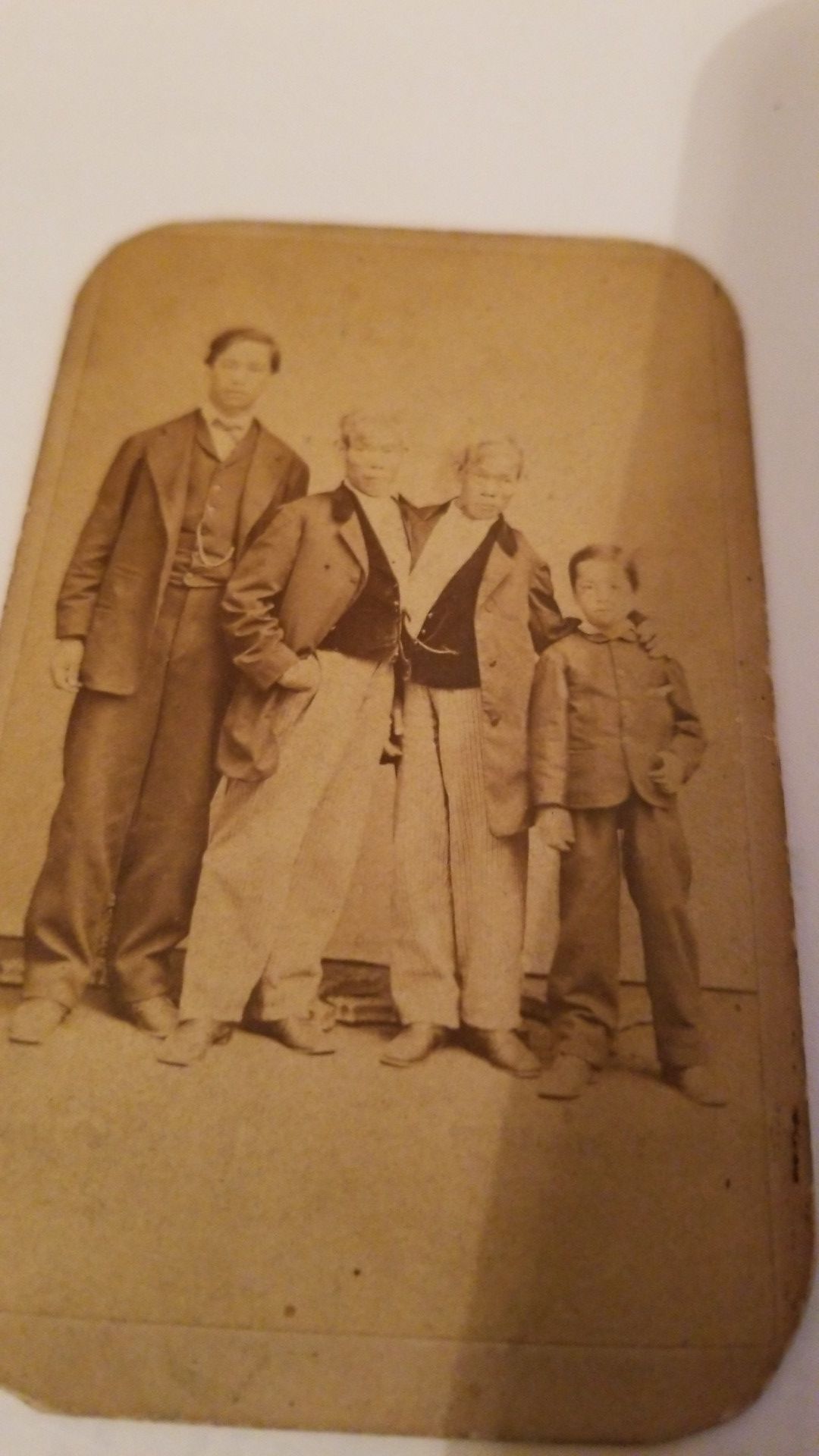 Real Photo Card of Eng and Chang Bunker, 1st photos Siamese Twins