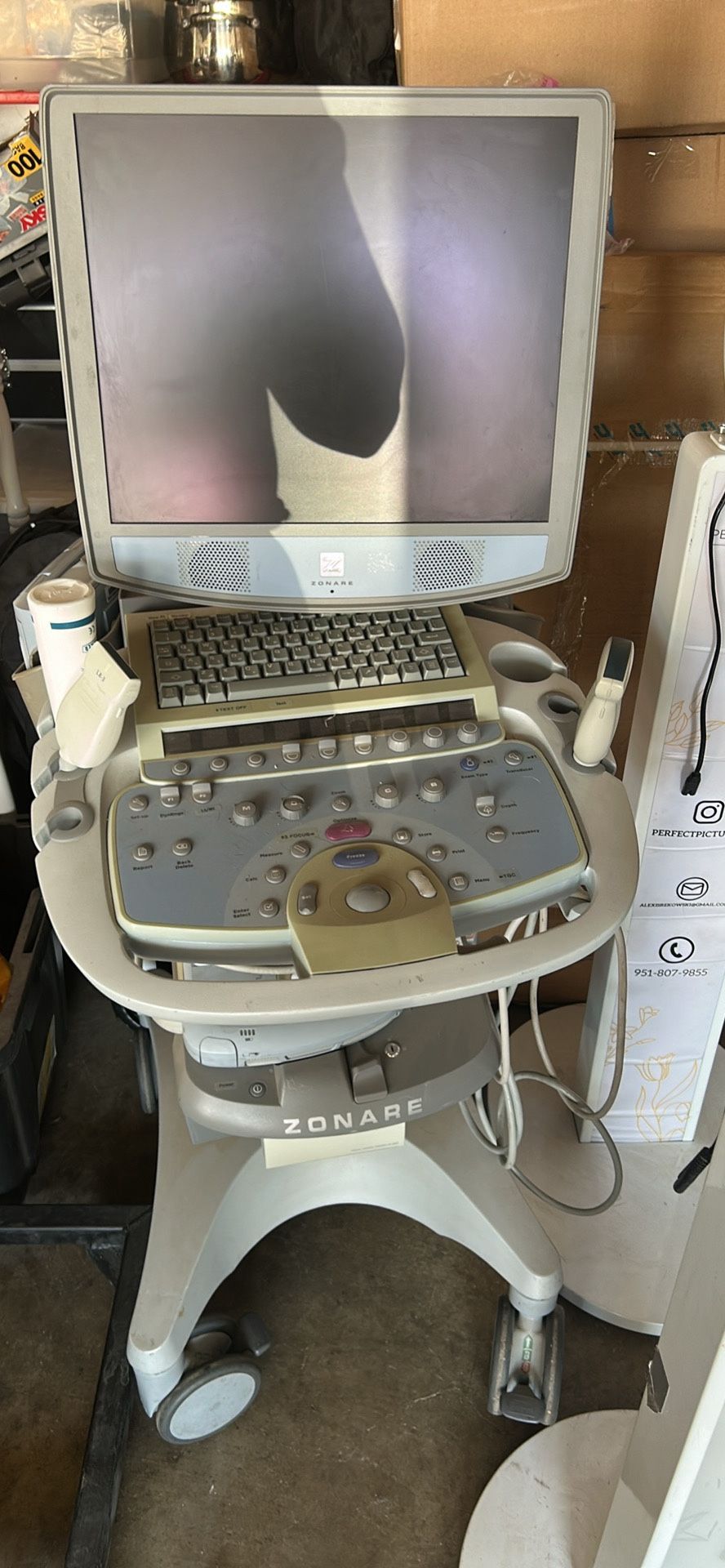 Zonare Ultrasound