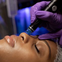 Hydra Facial