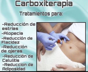 Tratamiento Con Carboxiterapia