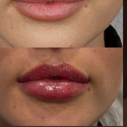 Labios lindos y sensuales  💋🫦👄