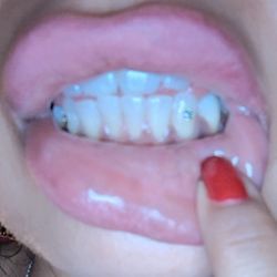 Tooth Gems