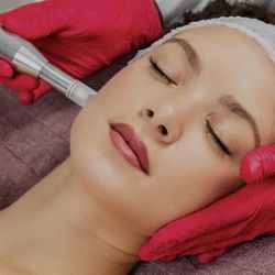 Spring Special: Micro needling 