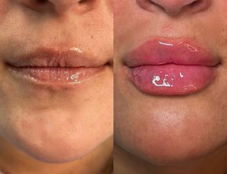 Lips 👄