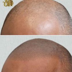 Permanent Shadow