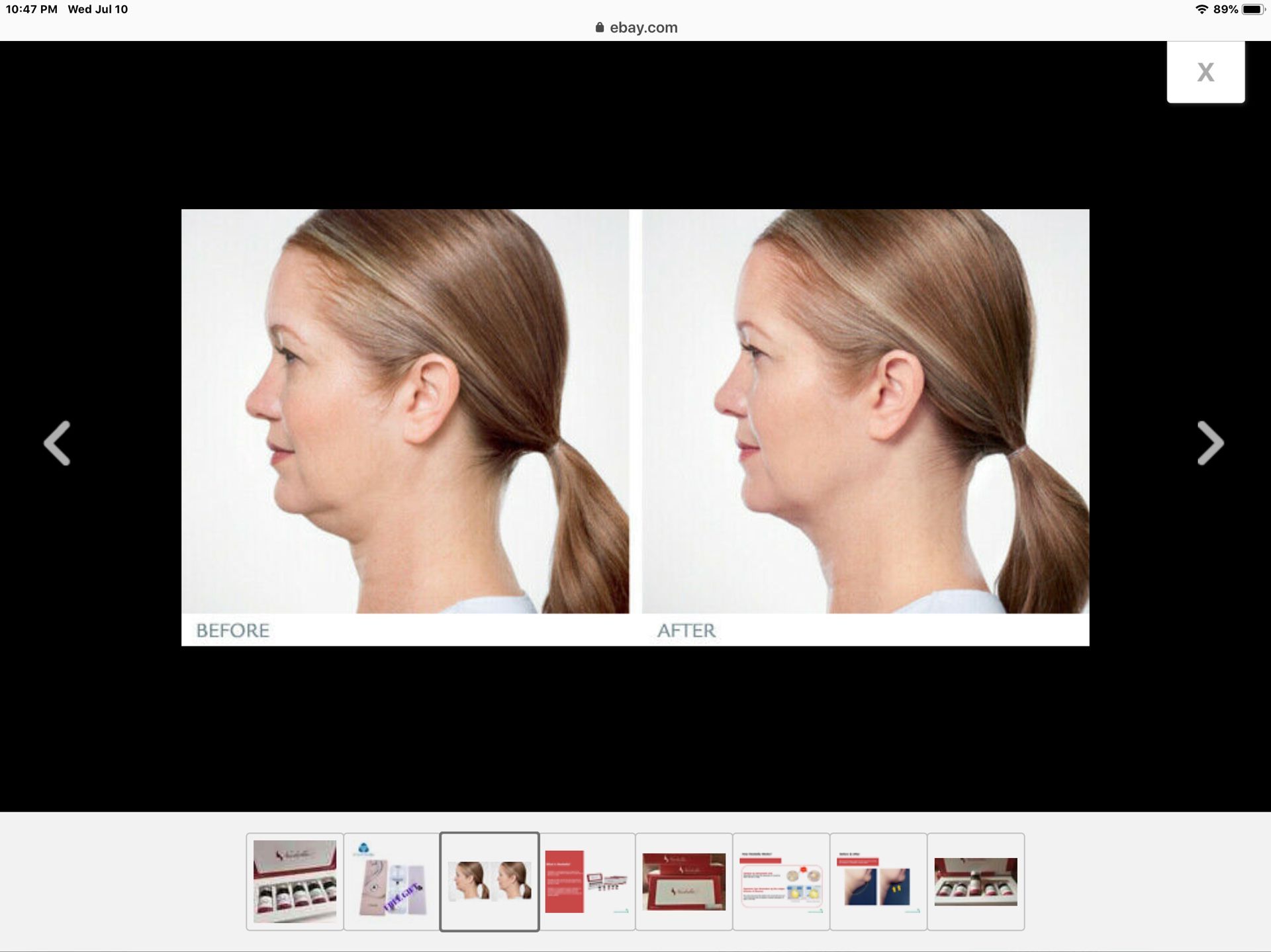 Neobella-Double Chin Gone!!!