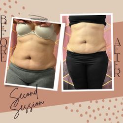 6 In 1 Body Sculpting 