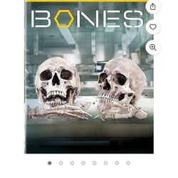 Bones 