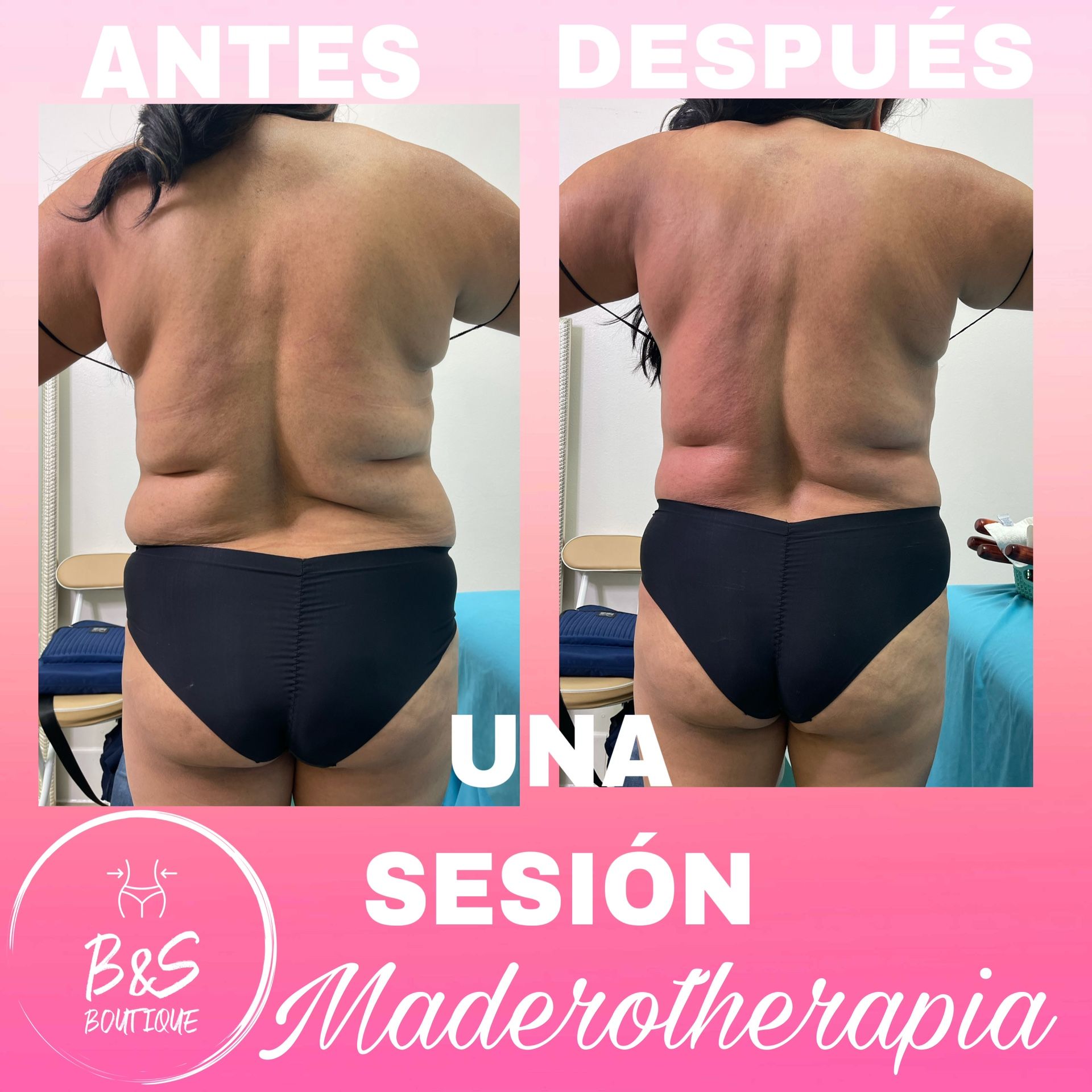 Cavitation 8 In 1 Machine For Sale Other - Health & Beauty