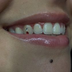 Tooth Gems 💎