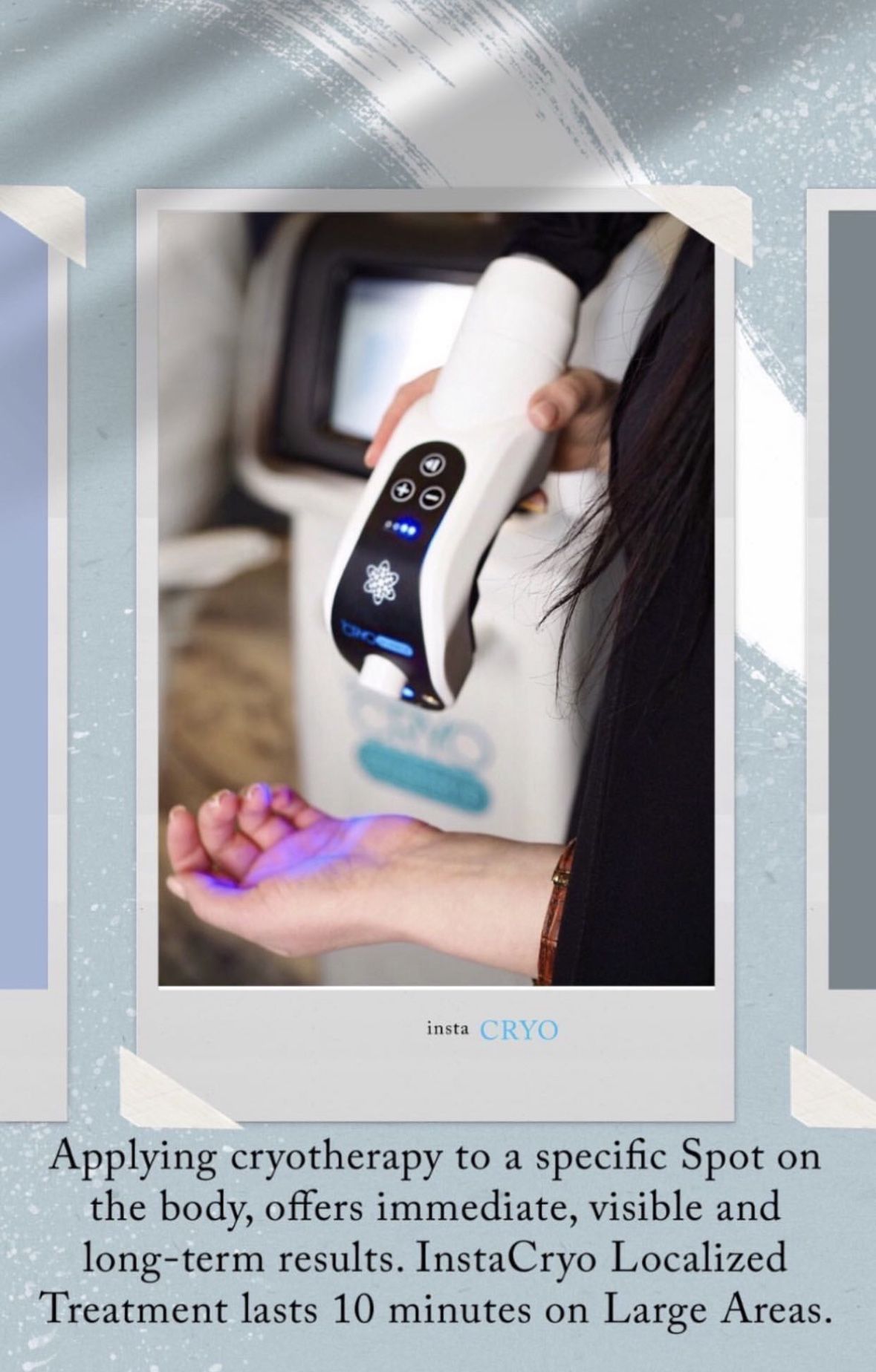 Localized Cryotherapy Machine