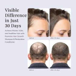 Hair Growth Shampoo and Conditioner Set - Rosemary & Biotin Shampoo and Conditioner for Hair Thickening $9.99