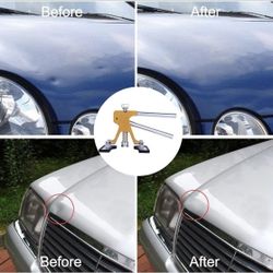 Gliston Auto Dent Puller Kit - Adjustable Golden Dent Remover Tools Paintless Dent Repair Kit Dent Lifter Puller for Car Large & Small Ding Hail Dent 