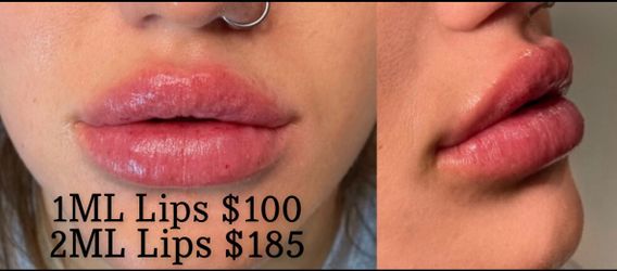 Lips
