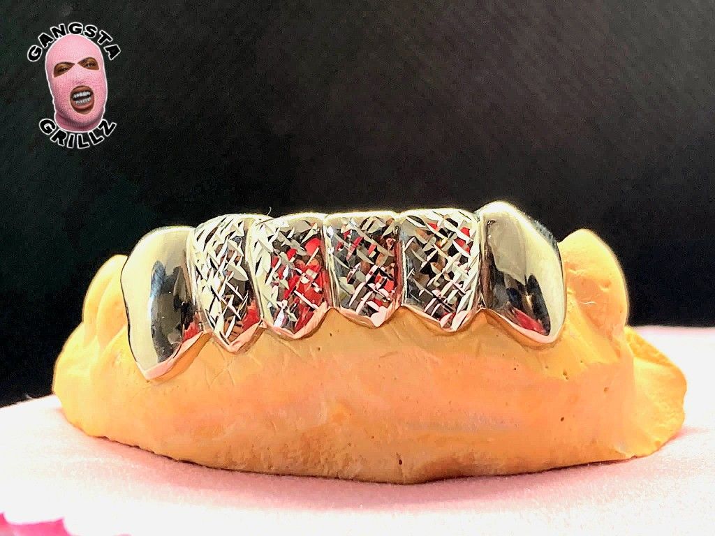 Gold Grillz
