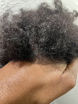 Hair Loss Units For Men/Women  Thumbnail
