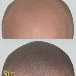 Permanent Shadow 