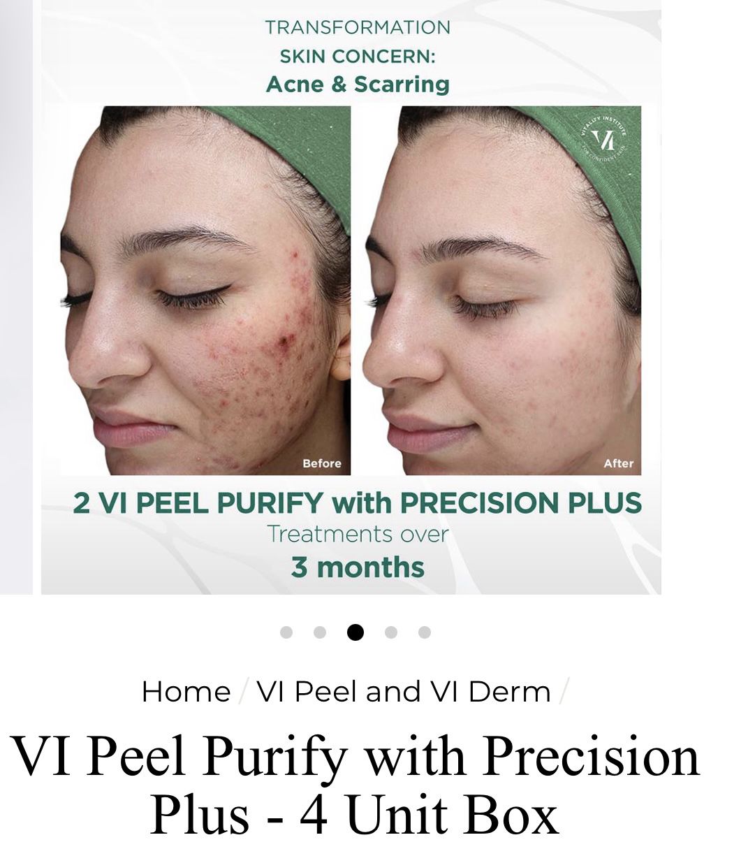Vi Peel Prescion Plus Purify Kit 