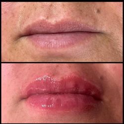 Lips