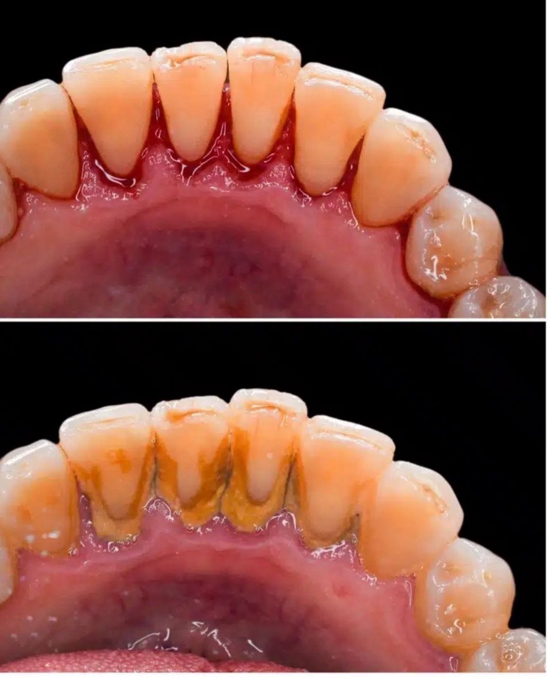 FREE DENTAL CLEANING